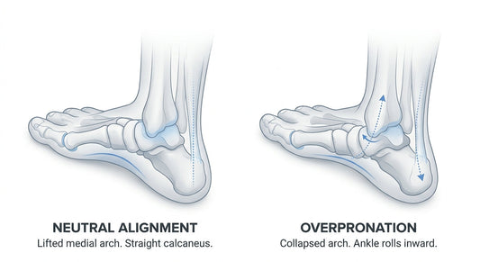 Best Insoles for Flat Feet: What to Look For in 2026